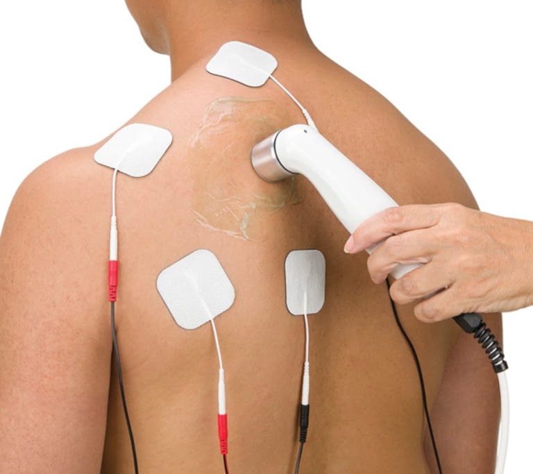 Electrical stimulation therapy applied to a patient's back